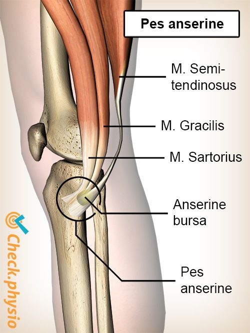 knee pes anserine bursa sartorius gracilis semitendinosus tendons gooses foot syndrome