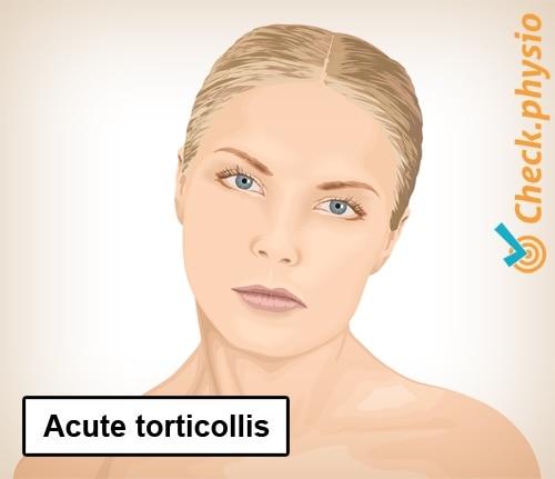 neck torticollis wry posture