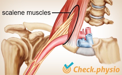shoulder arm hand TOS thoracic outlet syndrome scalene