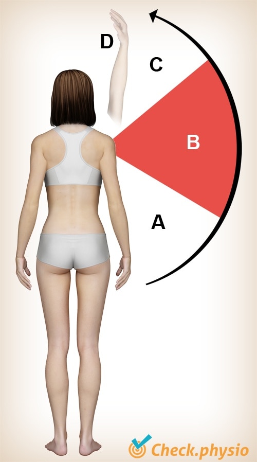 shoulder impingement painful arc