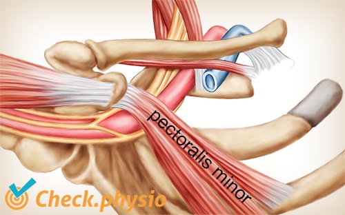 shoulder arm hand TOS thoracic outlet syndrome pectoralis minor