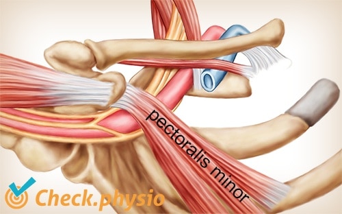 shoulder arm hand TOS thoracic outlet syndrome pectoralis minor