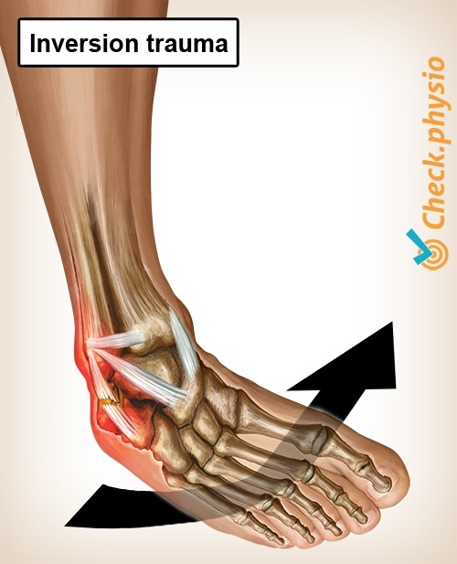 ankle inversion trauma ankle ligaments anatomy