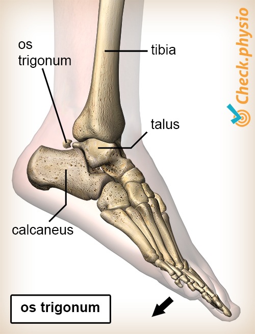 ankle posterior impingement os trigonum