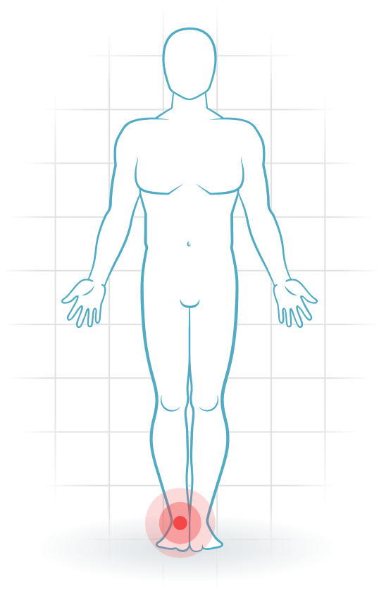 pijnlocatie Ankle instability