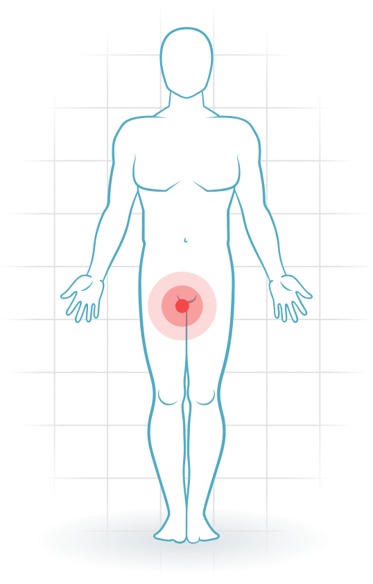 pijnlocatie Adduction-related groin pain